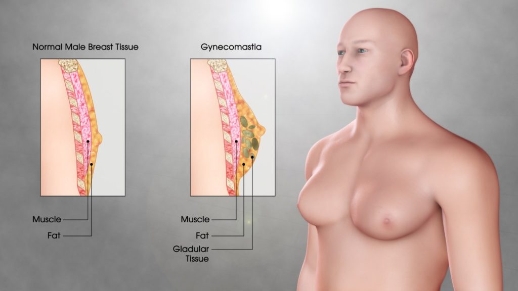 breast clinic in vizag