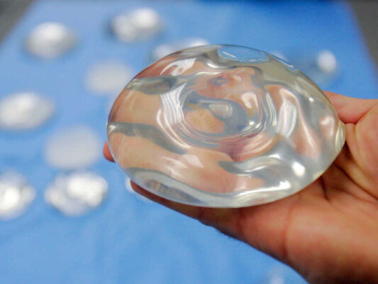 Federal health officials said in June that the latest data on silicone breast implants show they are relatively safe, despite frequent complications that lead about one in five women to have the implants removed within ten years.